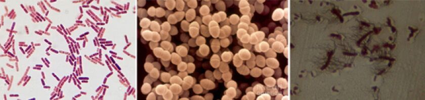 Escherichia coli, väljaheide enterococcus ja proteus on kroonilise bakteriaalse prostatiidi peamised põhjustajad